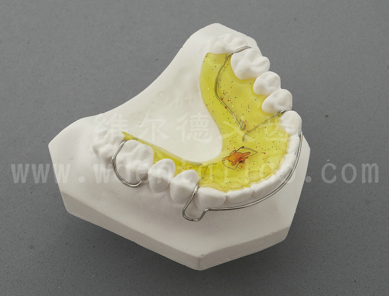 Orthodontics Lab - Wraparound Retainer