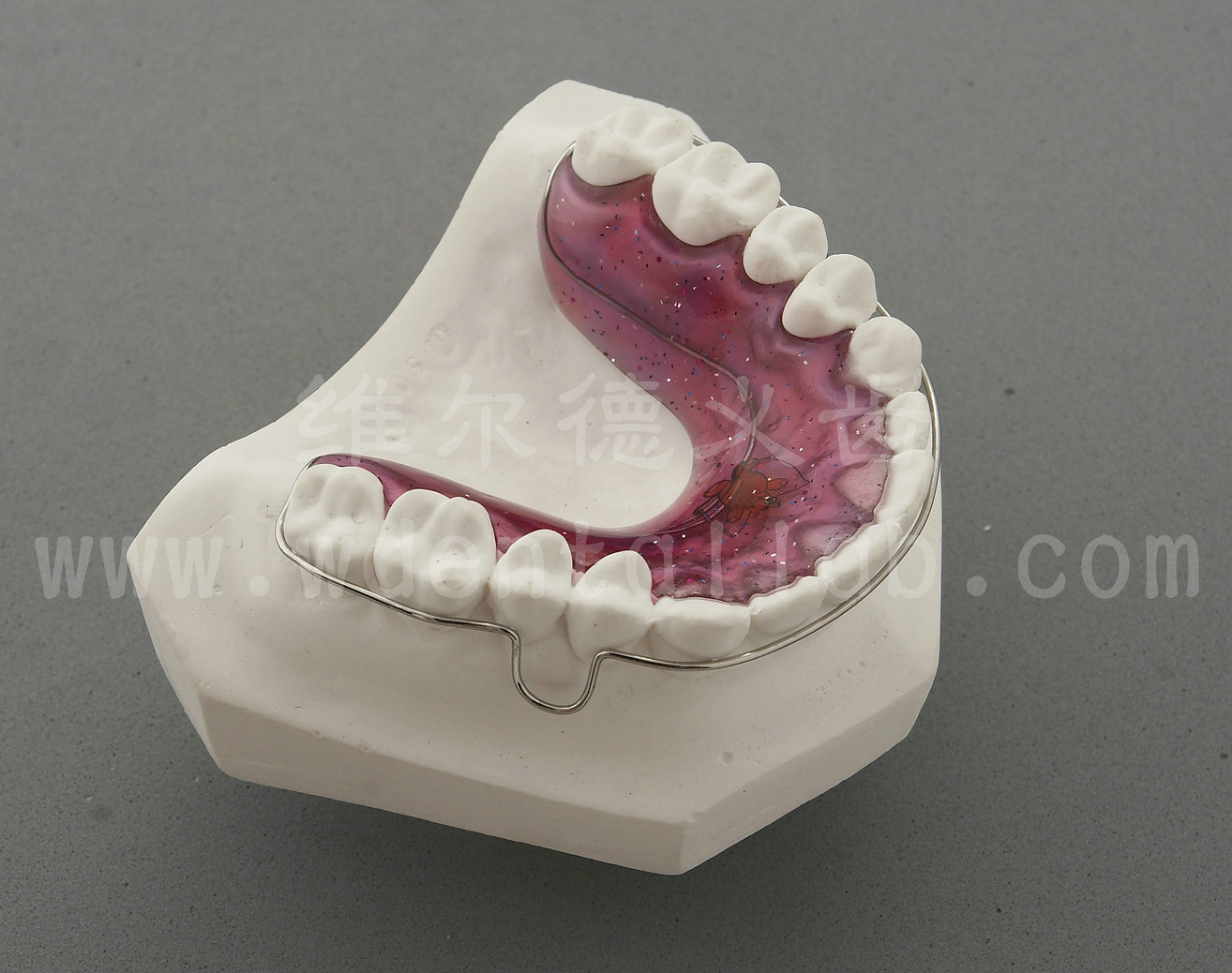 Orthodontics Lab - Wraparound Retainer