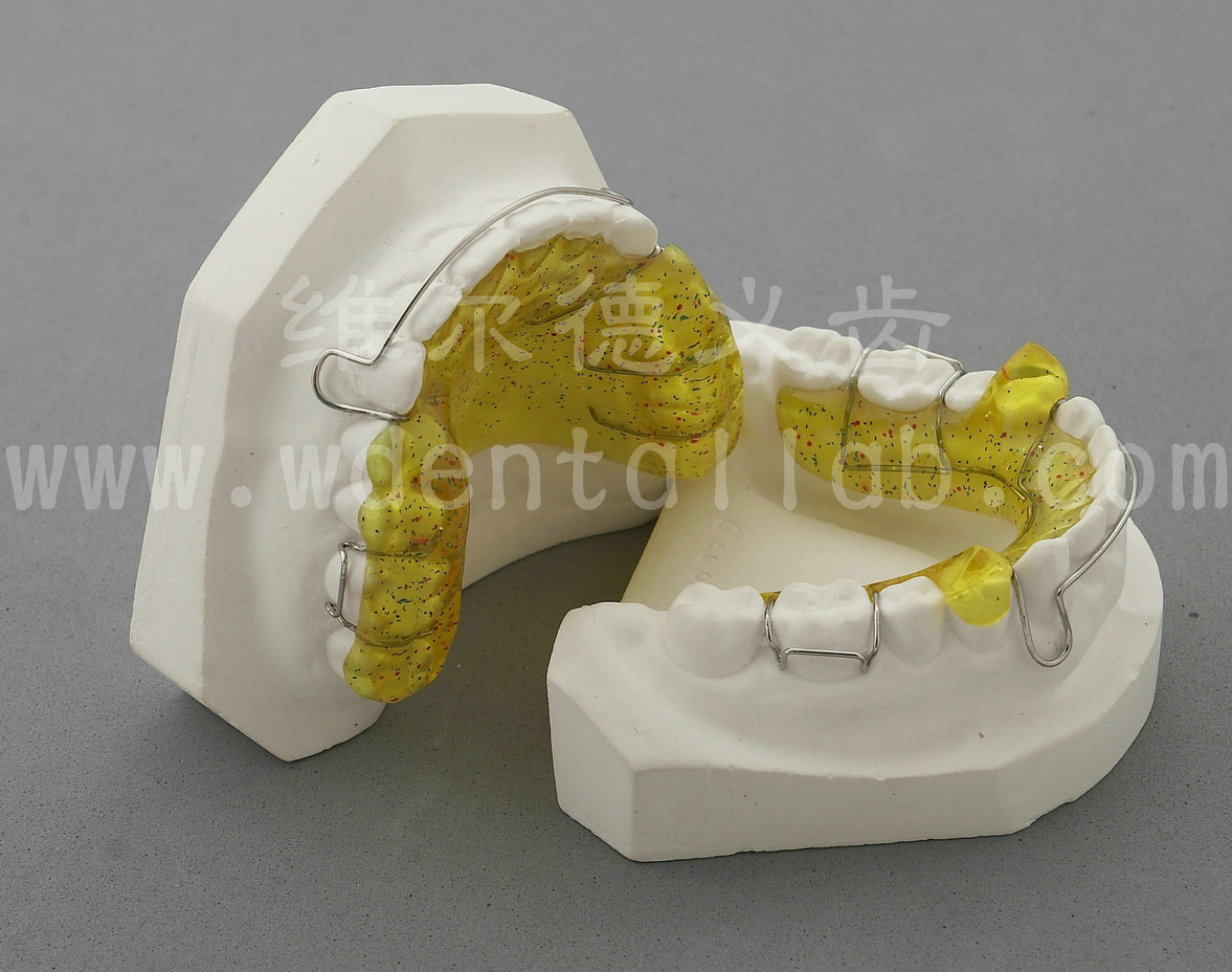 如用于安氏ii类ii分类病例,上前牙颚侧基托内加双曲舌簧.